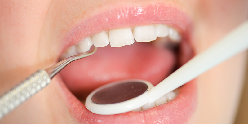 Restorative Dentistry