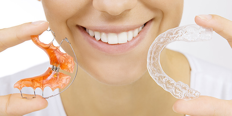 Orthodontic Treatment Methods