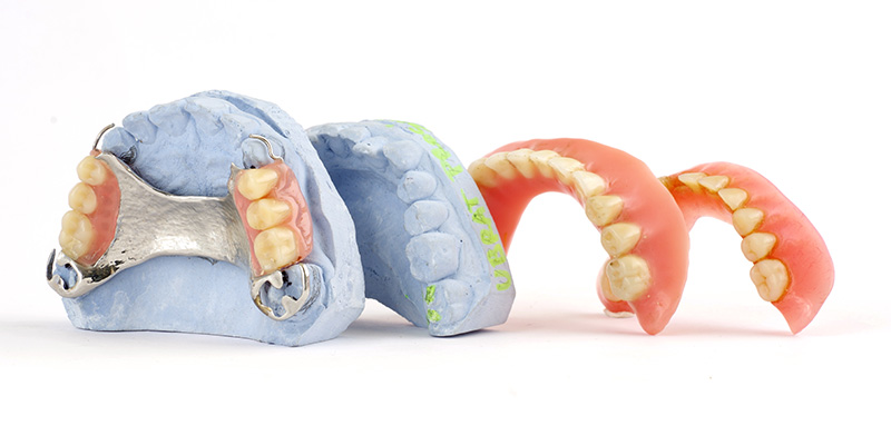 Prosthetic Treatments